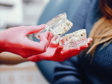 Plastic jaw in the dentist's office. The doctor holds in the hands of dental implants.